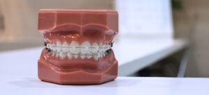 braces and orthodontic busy season